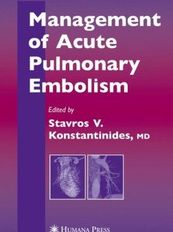 Management of Accute Pulmonary Embolism Online Hot Sale